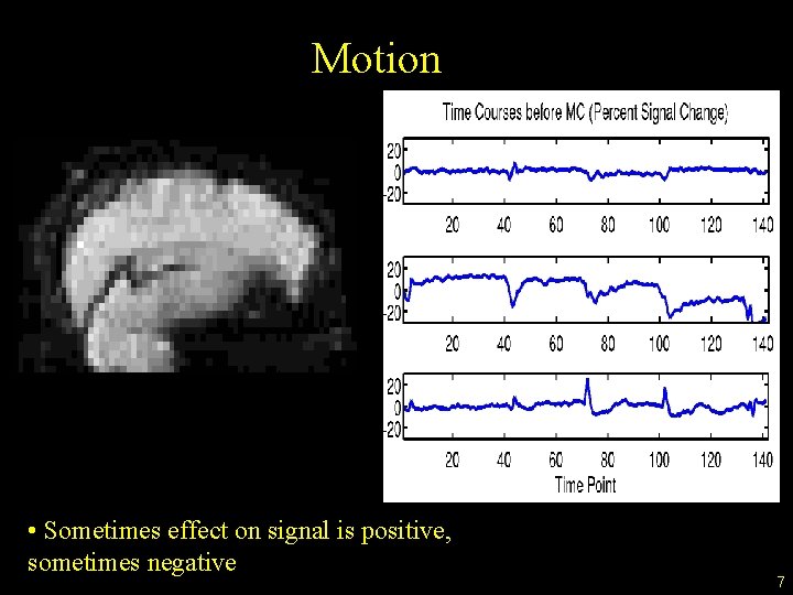 Motion • Sometimes effect on signal is positive, sometimes negative 7 