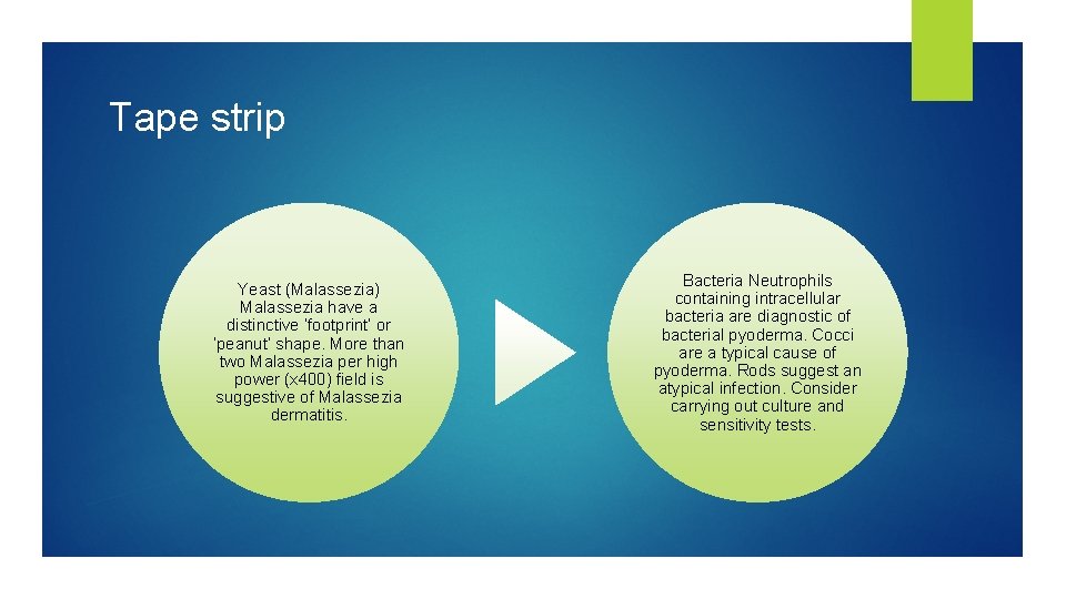 Tape strip Yeast (Malassezia) Malassezia have a distinctive ‘footprint’ or ‘peanut’ shape. More than