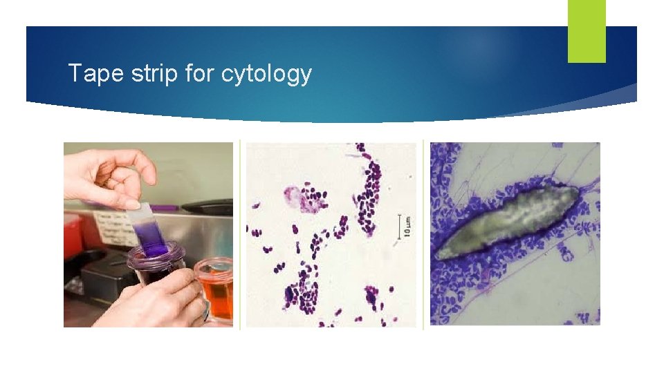 Tape strip for cytology 