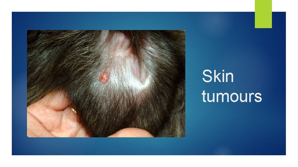 Skin tumours 