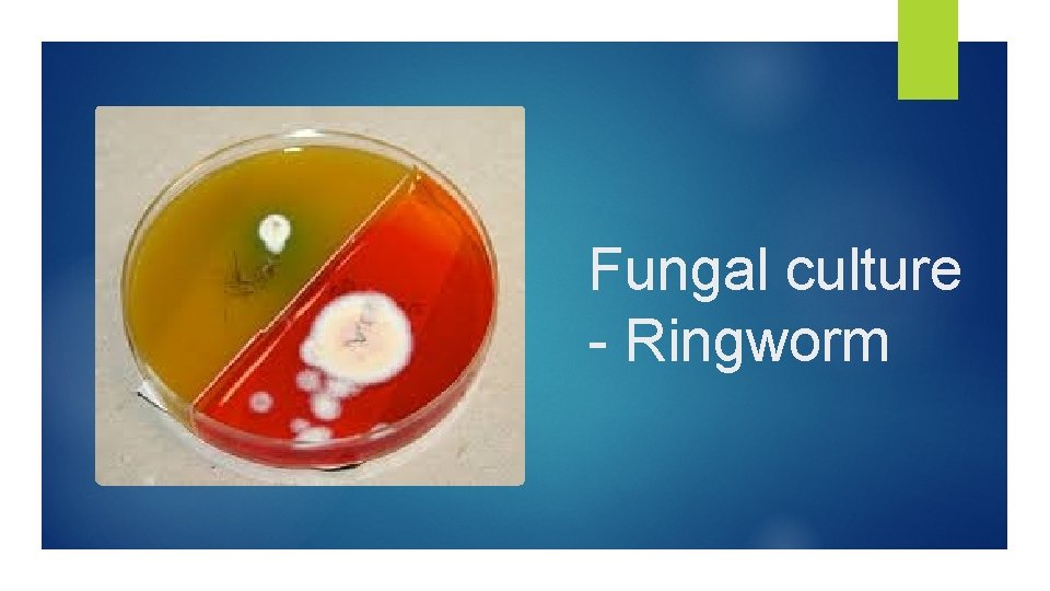 Fungal culture - Ringworm 