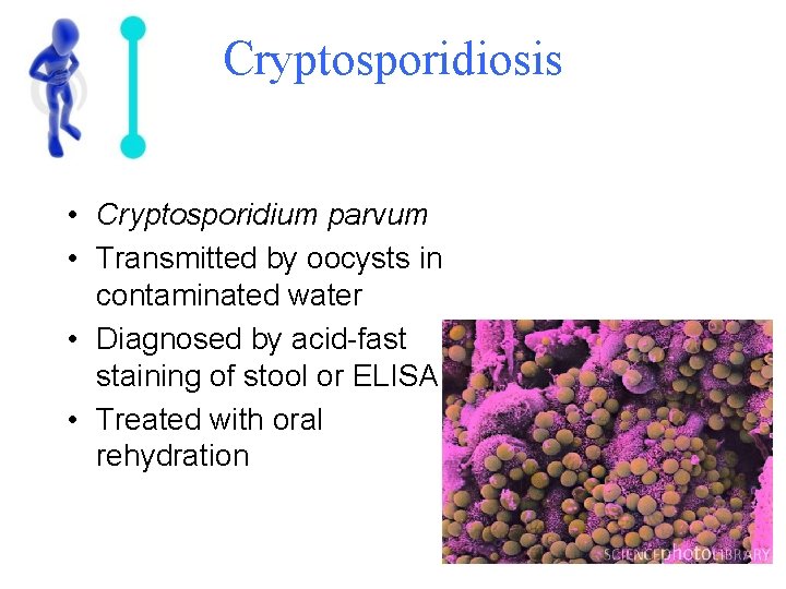 Cryptosporidiosis • Cryptosporidium parvum • Transmitted by oocysts in contaminated water • Diagnosed by