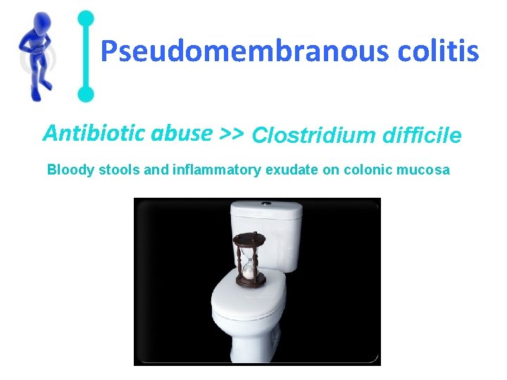 Pseudomembranous colitis Antibiotic abuse >> Clostridium difficile Bloody stools and inflammatory exudate on colonic