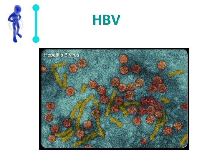 HBV 
