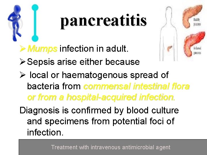pancreatitis Ø Mumps infection in adult. Mumps Ø Sepsis arise either because Ø local
