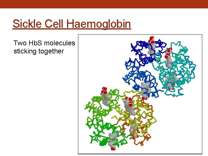 Sickle Cell Haemoglobin Two Hb. S molecules sticking together 