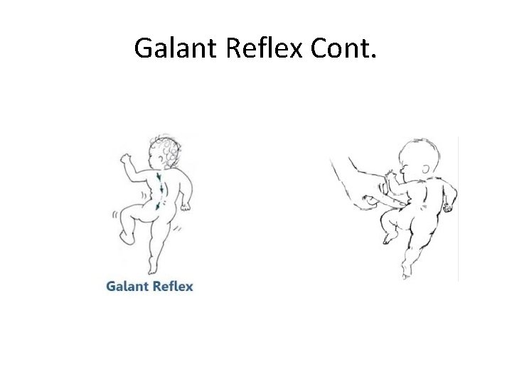 Galant Reflex Cont. 