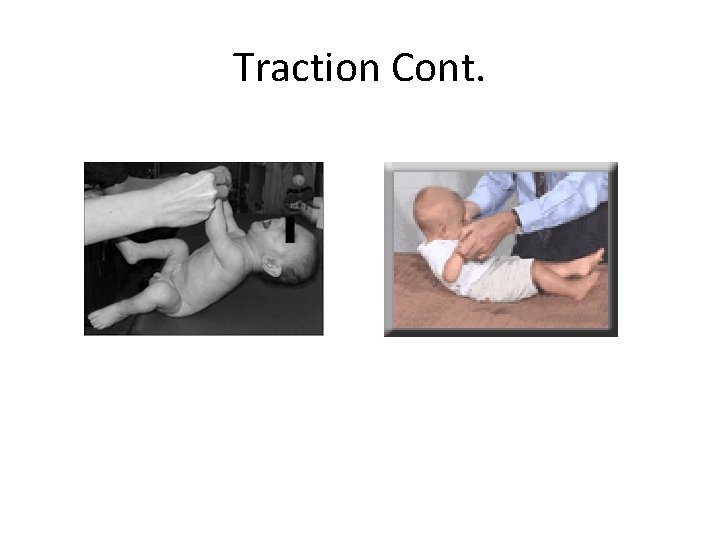 Traction Cont. 