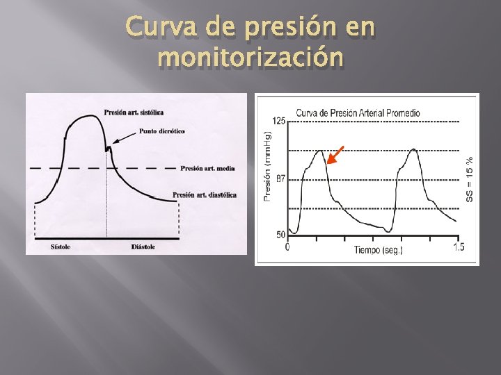 Curva de presión en monitorización 