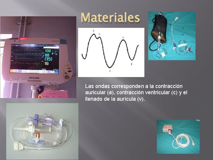 Materiales Las ondas corresponden a la contracción auricular (a), contracción ventricular (c) y el