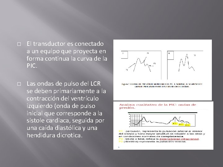 � � El transductor es conectado a un equipo que proyecta en forma continua