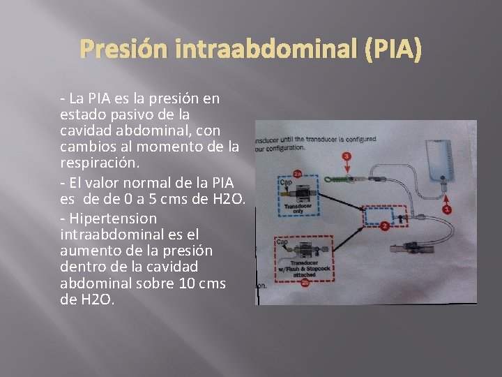 Presión intraabdominal (PIA) - La PIA es la presión en estado pasivo de la