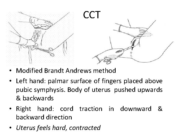 CCT • Modified Brandt Andrews method • Left hand: palmar surface of fingers placed