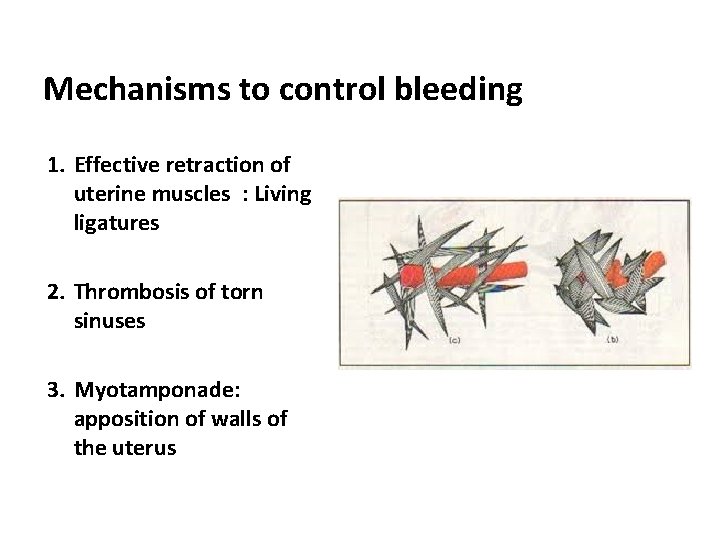 Mechanisms to control bleeding 1. Effective retraction of uterine muscles : Living ligatures 2.