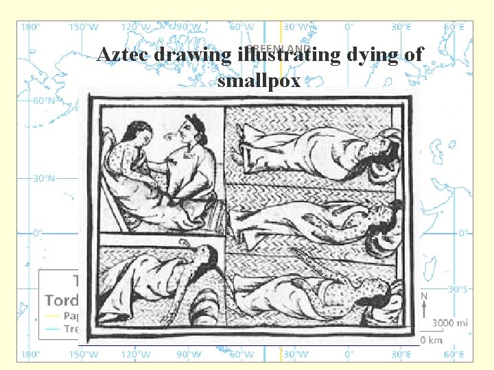 Aztec drawing illustrating dying of smallpox 