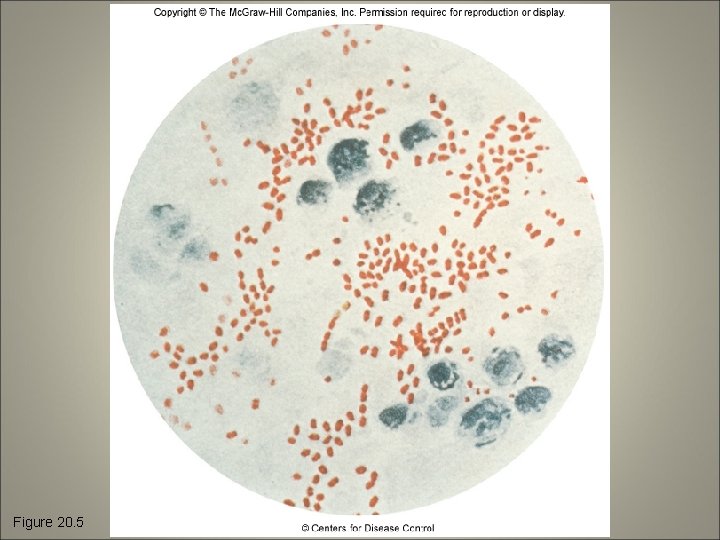 Figure 20. 5 