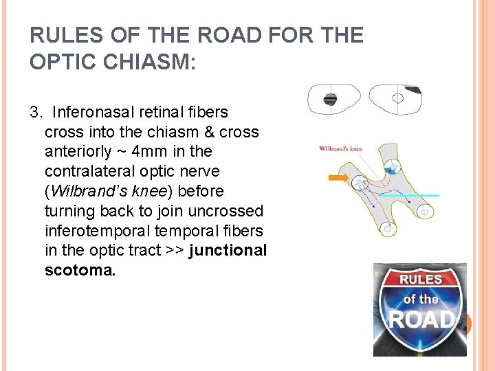 RULES OF THE ROAD FOR THE OPTIC CHIASM: 3. Inferonasal retinal fibers cross into