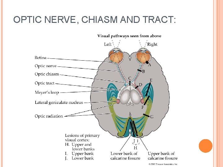 OPTIC NERVE, CHIASM AND TRACT: 