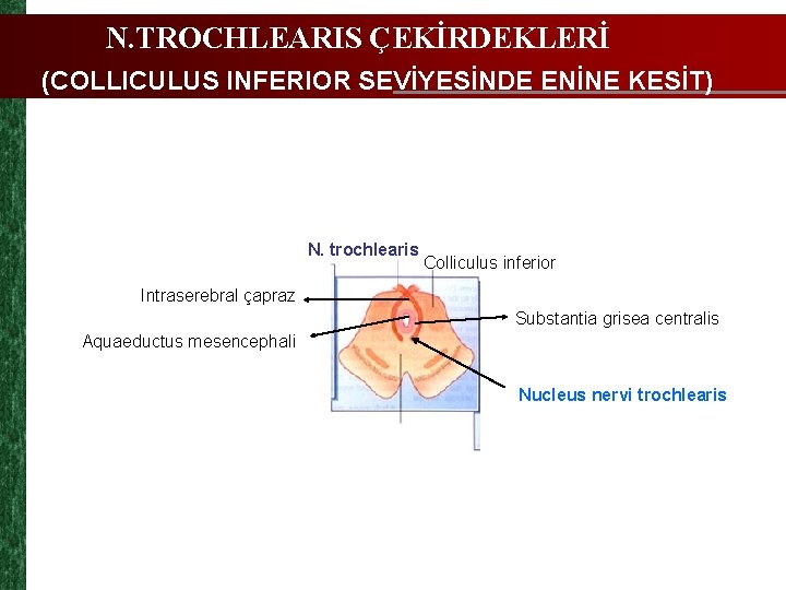 N. TROCHLEARIS ÇEKİRDEKLERİ (COLLICULUS INFERIOR SEVİYESİNDE ENİNE KESİT) N. trochlearis Colliculus inferior Intraserebral çapraz