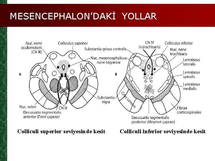 MESENCEPHALON’DAKİ YOLLAR Colliculi superior seviyesinde kesit Colliculi inferior seviyesinde kesit 