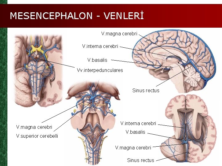 MESENCEPHALON - VENLERİ V. magna cerebri V. interna cerebri V. basalis Vv. interpedunculares Sinus