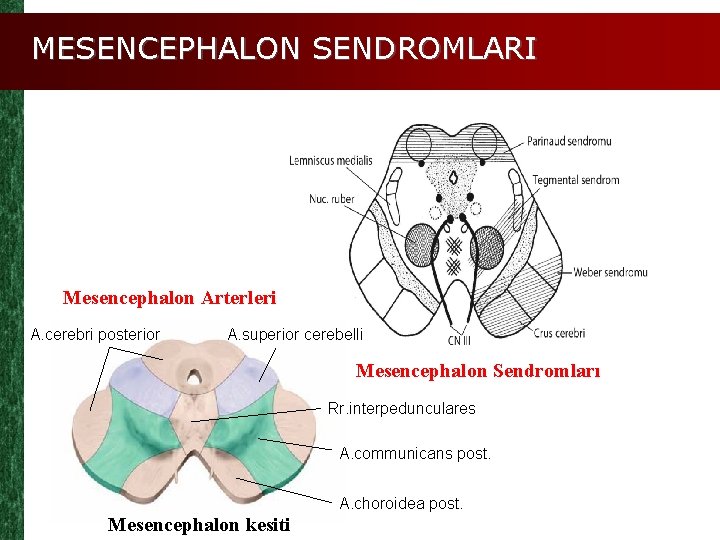 MESENCEPHALON SENDROMLARI Mesencephalon Arterleri A. cerebri posterior A. superior cerebelli Mesencephalon Sendromları Rr. interpedunculares