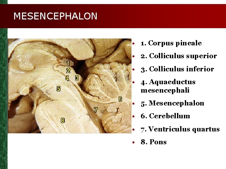 MESENCEPHALON • 1. Corpus pineale • 2. Colliculus superior • 3. Colliculus inferior •