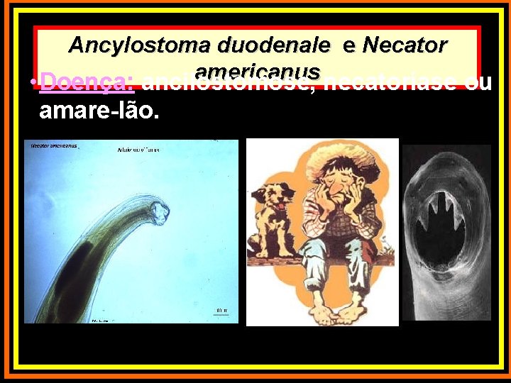 Ancylostoma duodenale e Necator americanus • Doença: ancilostomose, necatoríase ou amare-lão. 