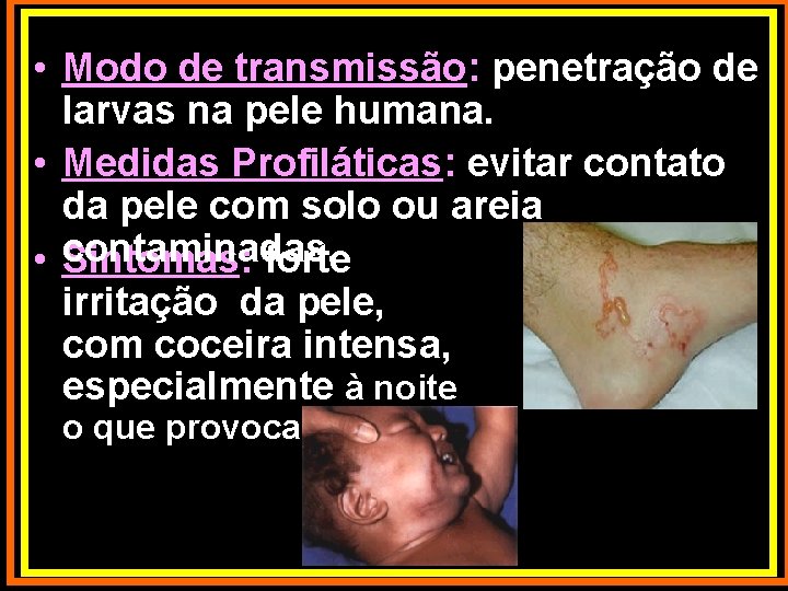  • Modo de transmissão: penetração de larvas na pele humana. • Medidas Profiláticas: