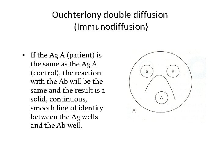 Ouchterlony double diffusion (Immunodiffusion) • If the Ag A (patient) is the same as Ouchterlony double diffusion (Immunodiffusion) • If the Ag A (patient) is the same as