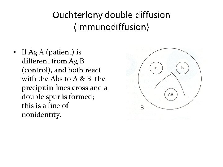 Ouchterlony double diffusion (Immunodiffusion) • If Ag A (patient) is different from Ag B Ouchterlony double diffusion (Immunodiffusion) • If Ag A (patient) is different from Ag B
