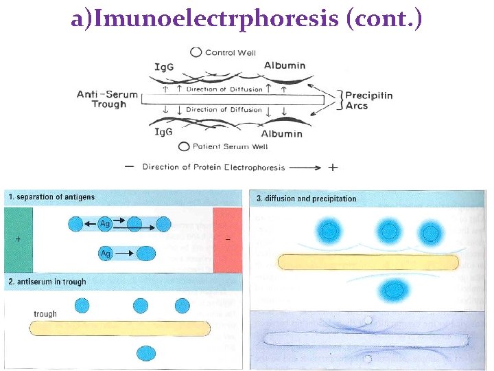 a)Imunoelectrphoresis (cont. ) a)Imunoelectrphoresis (cont. )