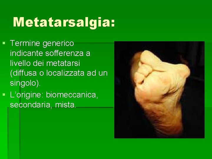 Metatarsalgia: § Termine generico indicante sofferenza a livello dei metatarsi (diffusa o localizzata ad