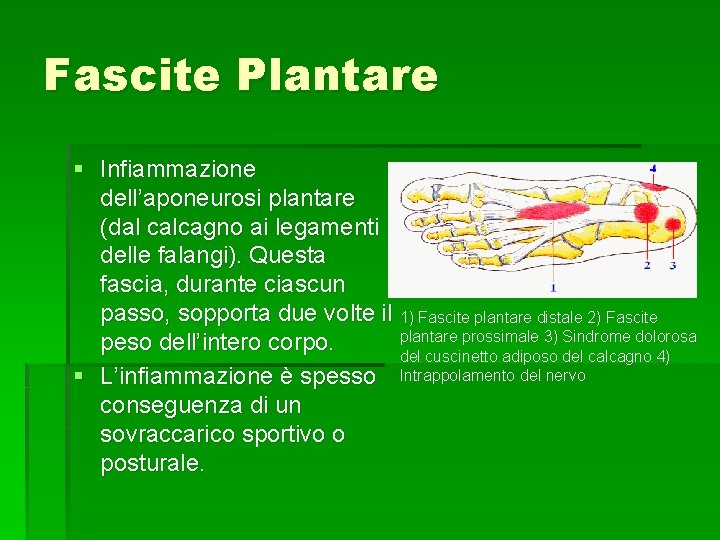 Fascite Plantare § Infiammazione dell’aponeurosi plantare (dal calcagno ai legamenti delle falangi). Questa fascia,