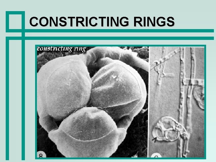 CONSTRICTING RINGS 