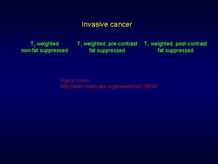 Invasive cancer T 2 weighted non-fat suppressed T 1 weighted, pre-contrast T 1 weighted,