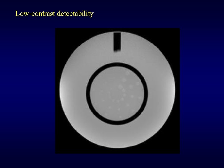 Low-contrast detectability 