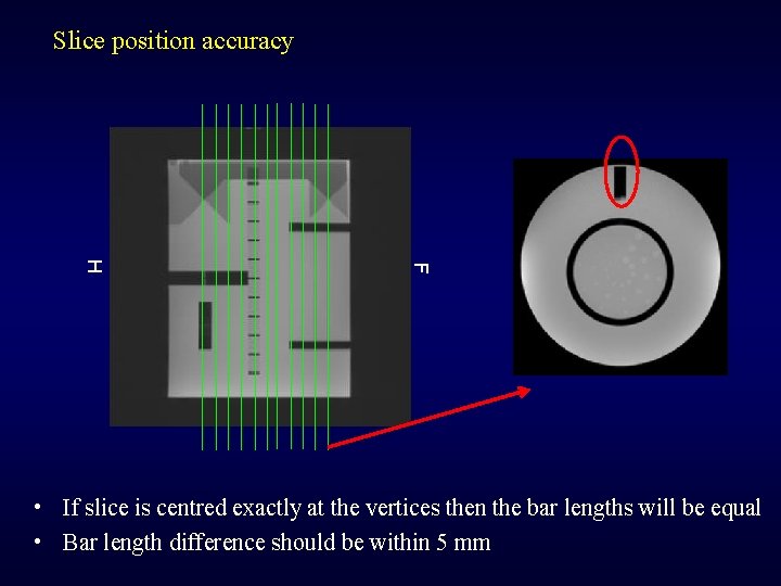 Slice position accuracy F H • If slice is centred exactly at the vertices
