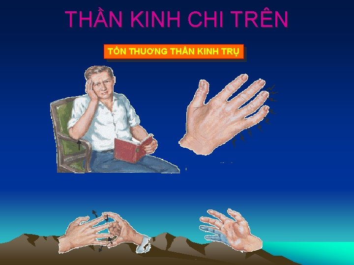 THẦN KINH CHI TRÊN TỔN THUƠNG THẦN KINH TRỤ 