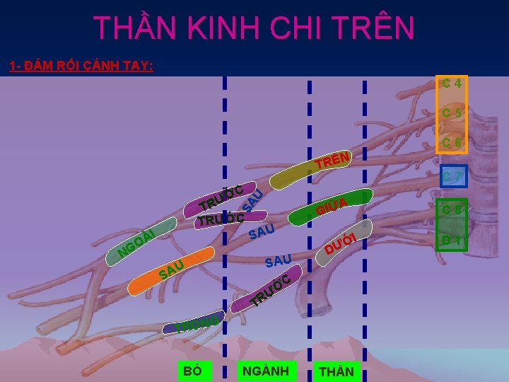 THẦN KINH CHI TRÊN 1 - ĐÁM RỐI CÁNH TAY: C 4 C 5