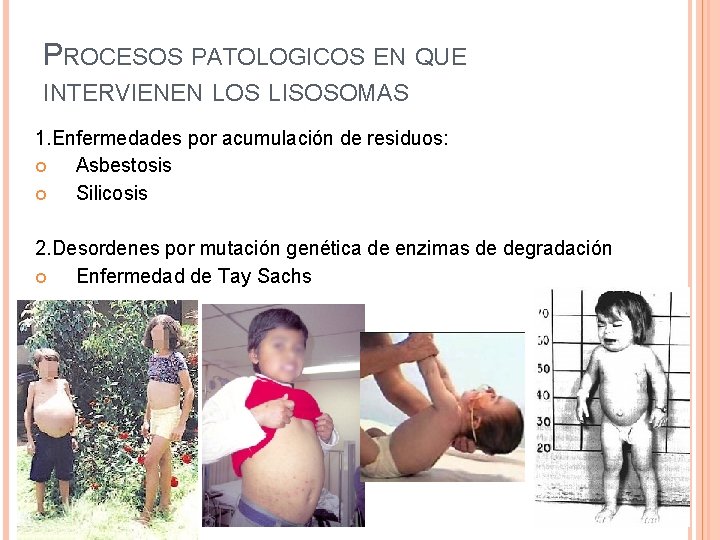 PROCESOS PATOLOGICOS EN QUE INTERVIENEN LOS LISOSOMAS 1. Enfermedades por acumulación de residuos: Asbestosis