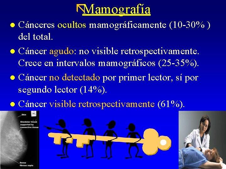 ãMamografía Cánceres ocultos mamográficamente (10 -30% ) del total. l Cáncer agudo: no visible