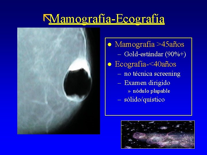 ãMamografía-Ecografía l Mamografía >45 años – Gold-estándar (90%+) l Ecografía-<40 años – no técnica