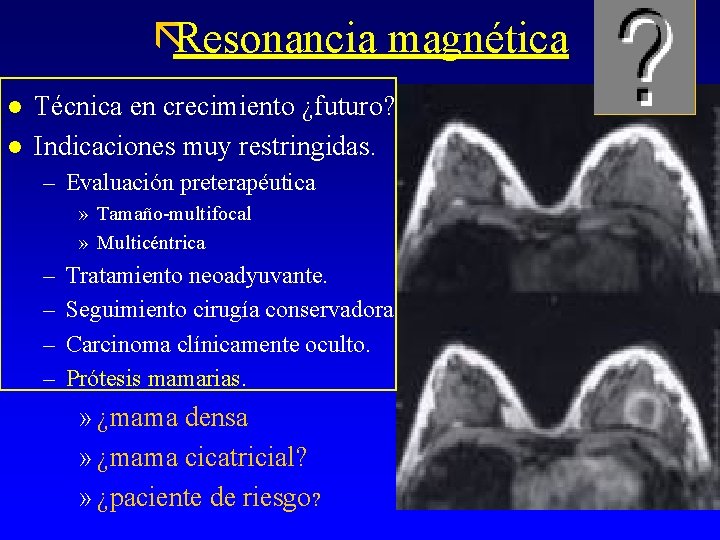 ãResonancia magnética l l Técnica en crecimiento ¿futuro? Indicaciones muy restringidas. – Evaluación preterapéutica