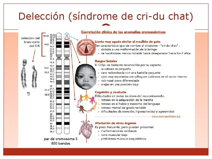 Delección (síndrome de cri-du chat) 