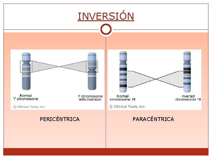 INVERSIÓN PERICÉNTRICA PARACÉNTRICA 