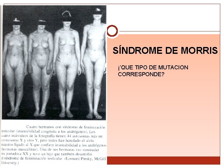 SÍNDROME DE MORRIS ¡’QUE TIPO DE MUTACION CORRESPONDE? 