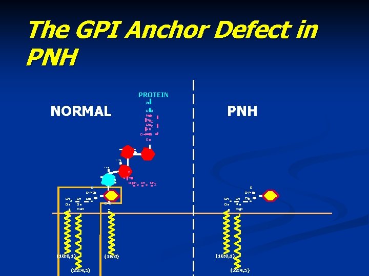 The GPI Anchor Defect in PNH PROTEIN Asp NORMAL PNH C=O NH CH 2