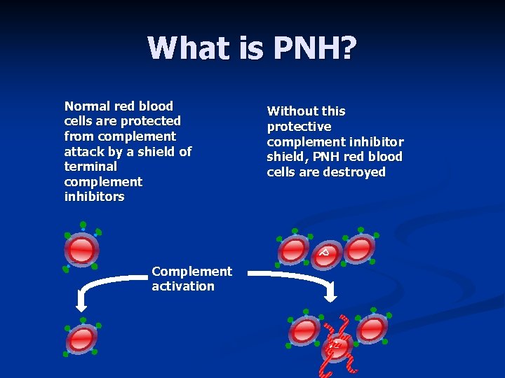 What is PNH? Normal red blood cells are protected from complement attack by a