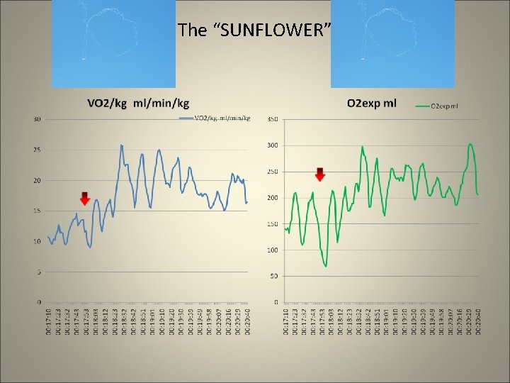 The “SUNFLOWER” 